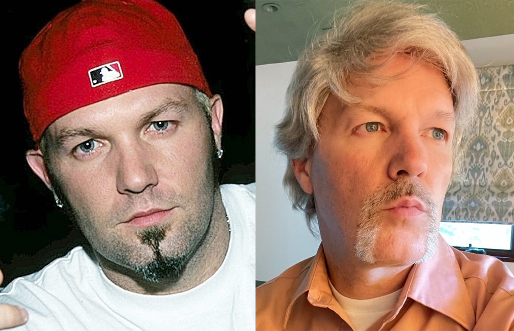 Fred Durst, do Limp Bizkit, muda visual e é comparado com Jon Bon Jovi