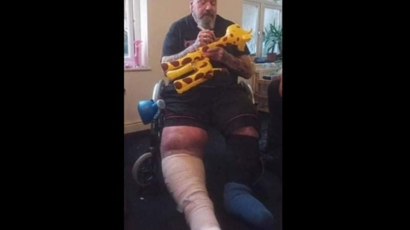 Paul Di'Anno, ex-Iron Maiden, aparece com pernas inchadas em cadeira de rodas