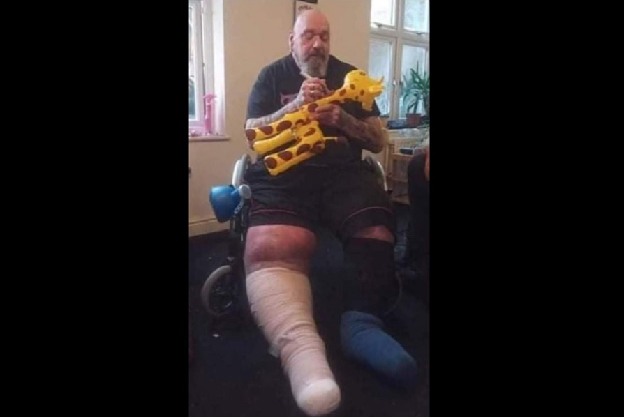 Paul Di’Anno, ex-Iron Maiden, aparece com pernas inchadas em cadeira de rodas