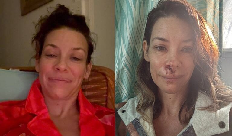 Evangeline Lilly, de 'Lost' e 'Homem-Formiga', revela dano cerebral após acidente